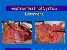Gastric Problems