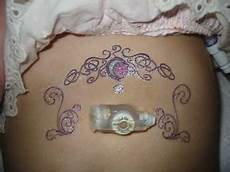 Gastric Problems