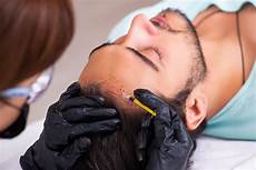 Hair Loss Solution