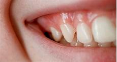 Healthy Teeth
