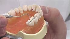 Healthy Teeth