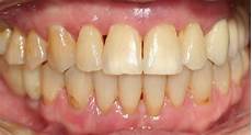 Healthy Teeth