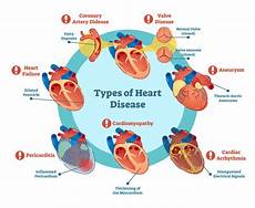 Heart Disease