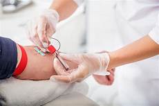 Hepatitis B