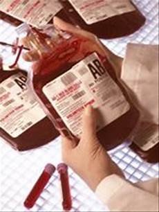 Hepatitis B