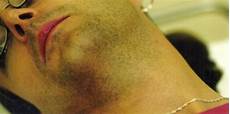 Ipl Hair Removal Machine