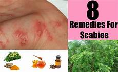 Itching Remedies Alternative Natural