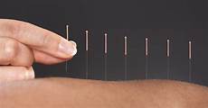 Itching Remedies Alternative Natural