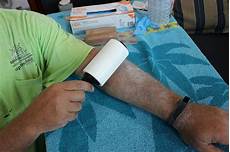 Lint Removers
