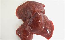 Liver Spots