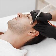 Microdermabrasion Machine