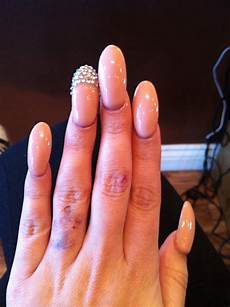 Nail Form
