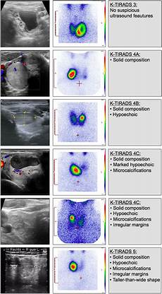 Nuclear Medicine