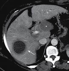 Nuclear Medicine
