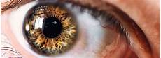 Optical Lenses