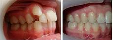 Oral-Hygiene-Products
