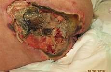 Other Body Parts