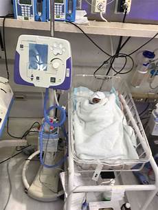 Oxygen Monitoring