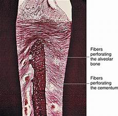 Perforating
