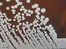 Permanganate