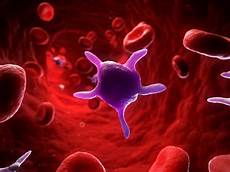 Rheumatoid Arthritis