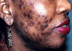 Skin Care Products