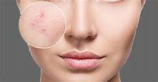 Skin Rejuvenation Equipment