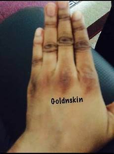 Skin Whitening