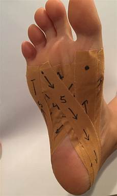 Strapping