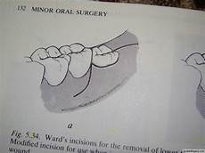 Surgical Blades