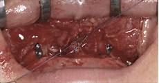 Surgical Equipment