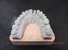 Teeth Setting Machine