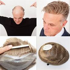 Toupee