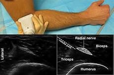Ultrasound Therapy