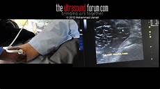 Ultrasound Therapy