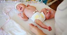 Umbilical Clamp