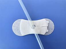 Urethral Catheter