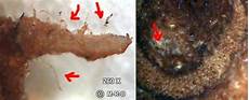 Worms
