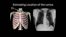 X Ray Tube