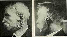 X Ray Viewer