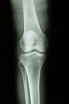 X Ray