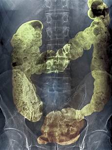 X Ray