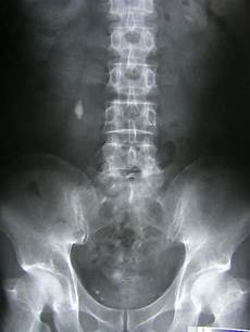 X Ray