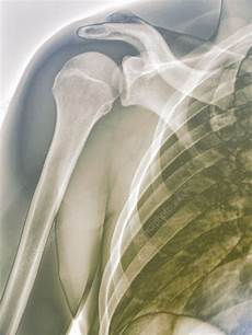 X Ray
