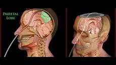 Xray Tube