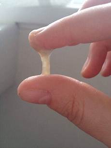 Yeast